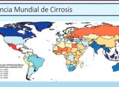 Hablemos sobre cirrosis