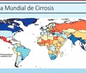 Hablemos sobre cirrosis